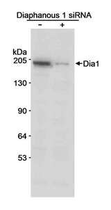 DIAPH1 Antibody - Detection of Human Diaphanous 1 by Western Blot. Samples: Whole cell lysate (50 ug/lane) from untreated or siRNA treated 293T cells. Antibody: Affinity purified rabbit anti-Diaphanous 1 antibody used at 0.1 ug/ml. Detection: Chemiluminescence with 10 second exposure.