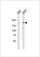DIAPH1 Antibody - Western blot of lysates from 293, 293T cell line (from left to right) with DIAPH1 Antibody. Antibody was diluted at 1:1000 at each lane. A goat anti-rabbit IgG H&L (HRP) at 1:5000 dilution was used as the secondary antibody. Lysates at 35 ug per lane.