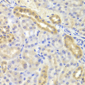 DIAPH1 Antibody - Immunohistochemistry of paraffin-embedded Mouse kidney tissue.