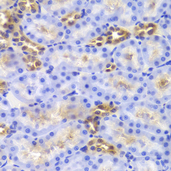 DIAPH1 Antibody - Immunohistochemistry of paraffin-embedded Rat kidney tissue.