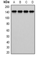 DIAPH1 Antibody - Western blot analysis of Dia 1 expression in MCF7 (A); HepG2 (B); mouse liver (C); mouse lung (D) whole cell lysates.
