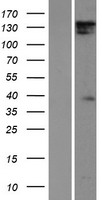 DIAPH1 Protein - Western validation with an anti-DDK antibody * L: Control HEK293 lysate R: Over-expression lysate