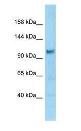 DIAPH2 Antibody - DIA / DIAPH2 antibody Western Blot of Rat Brain.  This image was taken for the unconjugated form of this product. Other forms have not been tested.