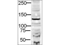DIAPH2 Antibody - Anti-DIA-2 Antibody - Western Blot. Western blot of Affinity Purified anti-DIA-2 antibody shows detection of a 132-kD band corresponding to DIA-2 in a lysate prepared from human derived HEK293 cells. Approximately 20 ug of lysate was run on a SDS-PAGE and transferred onto nitrocellulose followed by reaction with a 1:500 dilution of anti-DIA-2 antibody. Detection occurred using a 1:5000 dilution of HRP-labeled Goat anti-Rabbit IgG for 1 hour at room temperature. A chemiluminescence system was used for signal detection (Roche) using a 1 min exposure time.