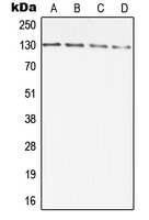 DIAPH2 Antibody - Western blot analysis of DIAPH2 expression in A431 (A); HCT116 (B); SP2/0 (C); PC12 (D) whole cell lysates.