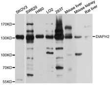 DIAPH2 Antibody - Western blot analysis of extract of various cells.