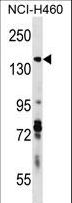 DIAPH3 / MDIA2 Antibody - DIAPH3 Antibody western blot of NCI-H460 cell line lysates (35 ug/lane). The DIAPH3 antibody detected the DIAPH3 protein (arrow).