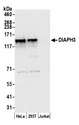 DIAPH3 / MDIA2 Antibody - Detection of human DIAPH3 by western blot. Samples: Whole cell lysate (50 µg) from HeLa, HEK293T, and Jurkat cells prepared using NETN lysis buffer. Antibody: Affinity purified rabbit anti-DIAPH3 antibody used for WB at 0.1 µg/ml. Detection: Chemiluminescence with an exposure time of 10 seconds.