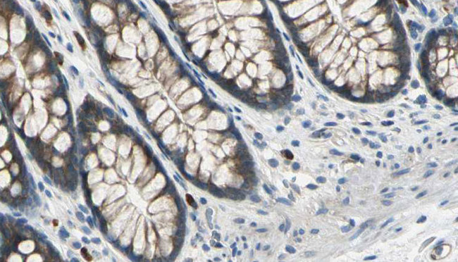 DIAPH3 / MDIA2 Antibody - 1:100 staining rat colon tissue by IHC-P. The sample was formaldehyde fixed and a heat mediated antigen retrieval step in citrate buffer was performed. The sample was then blocked and incubated with the antibody for 1.5 hours at 22°C. An HRP conjugated goat anti-rabbit antibody was used as the secondary.