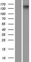 DIAPH3 / MDIA2 Protein - Western validation with an anti-DDK antibody * L: Control HEK293 lysate R: Over-expression lysate