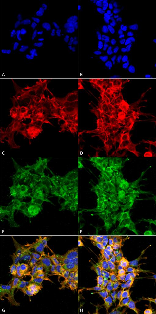 Dibromo-tyrosine Antibody - Immunocytochemistry/Immunofluorescence analysis using Mouse Anti-Dibromo-tyrosine Monoclonal Antibody, Clone 6G3. Tissue: Embryonic kidney epithelial cell line (HEK293). Species: Human. Fixation: 5% Formaldehyde for 5 min. Primary Antibody: Mouse Anti-Dibromo-tyrosine Monoclonal Antibody at 1:50 for 30-60 min at RT. Secondary Antibody: Goat Anti-Mouse Alexa Fluor 488 at 1:1500 for 30-60 min at RT. Counterstain: Phalloidin Alexa Fluor 633 F-Actin stain; DAPI (blue) nuclear stain at 1:250, 1:50000 for 30-60 min at RT. Magnification: 20X (2X Zoom). (A,C,E,G) - Untreated. (B,D,F,H) - Cells cultured overnight with 50 µM H2O2. (A,B) DAPI (blue) nuclear stain. (C,D) Phalloidin Alexa Fluor 633 F-Actin stain. (E,F) Dibromo-tyrosine Antibody. (G,H) Composite. Courtesy of: Dr. Robert Burke, University of Victoria.