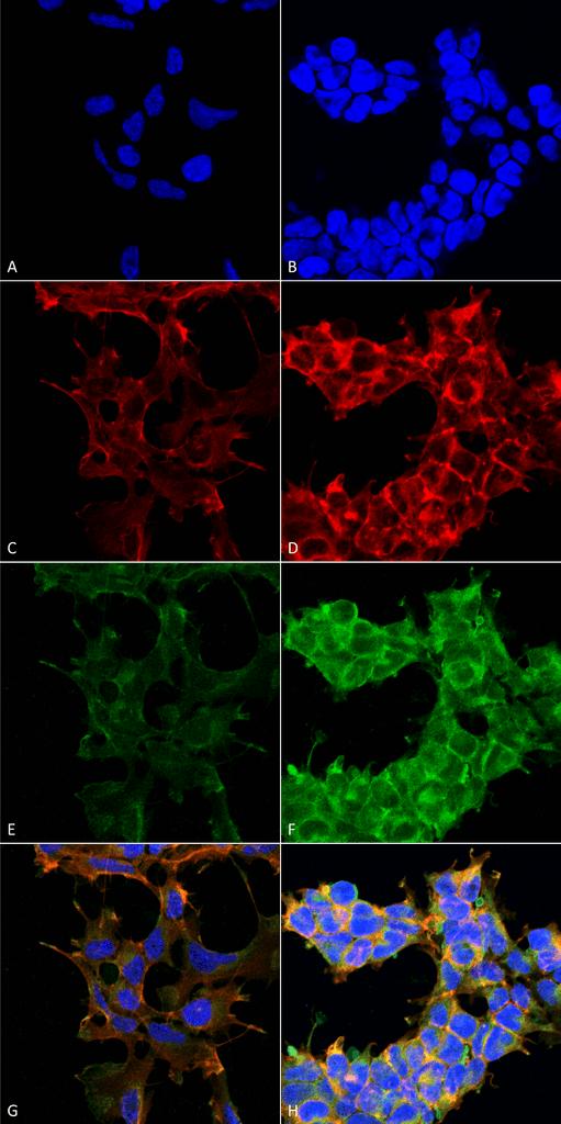 Dibromo-tyrosine Antibody - Immunocytochemistry/Immunofluorescence analysis using Mouse Anti-Dibromo-tyrosine Monoclonal Antibody, Clone 9F12. Tissue: Embryonic kidney epithelial cell line (HEK293). Species: Human. Fixation: 5% Formaldehyde for 5 min. Primary Antibody: Mouse Anti-Dibromo-tyrosine Monoclonal Antibody at 1:50 for 30-60 min at RT. Secondary Antibody: Goat Anti-Mouse Alexa Fluor 488 at 1:1500 for 30-60 min at RT. Counterstain: Phalloidin Alexa Fluor 633 F-Actin stain; DAPI (blue) nuclear stain at 1:250, 1:50000 for 30-60 min at RT. Magnification: 20X (2X Zoom). (A,C,E,G) - Untreated. (B,D,F,H) - Cells cultured overnight with 50 µM H2O2. (A,B) DAPI (blue) nuclear stain. (C,D) Phalloidin Alexa Fluor 633 F-Actin stain. (E,F) Dibromo-tyrosine Antibody. (G,H) Composite. Courtesy of: Dr. Robert Burke, University of Victoria.