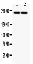 DICER1 / Dicer Antibody - Dicer antibody Western blot. All lanes: Anti Dicer at 0.5 ug/ml. Lane 1: HeLa Whole Cell Lysate at 40 ug. Lane 2: MCF-7 Whole Cell Lysate at 40 ug. Predicted band size: 217 kD. Observed band size: 217 kD.