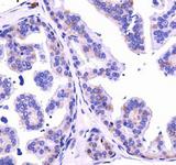 DICER1 / Dicer Antibody - Dicer Antibody - IHC of DICER in mouse prostate.