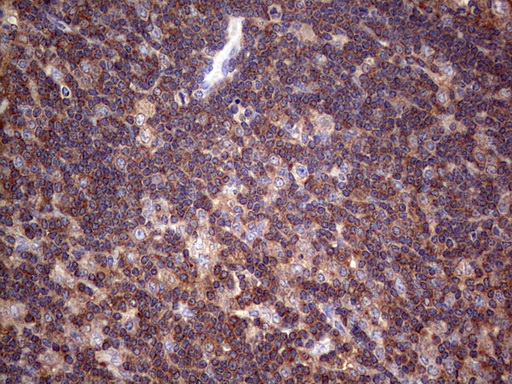 DICER1 / Dicer Antibody - IHC of paraffin-embedded Human lymph node tissue using anti-DICER1 mouse monoclonal antibody. (Heat-induced epitope retrieval by 1 mM EDTA in 10mM Tris, pH8.5, 120°C for 3min).