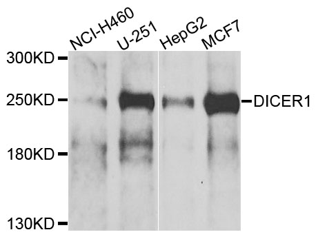 DICER1 / Dicer Antibody - Western blot analysis of extracts of various cells.