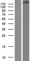 DICER1 / Dicer Protein - Western validation with an anti-DDK antibody * L: Control HEK293 lysate R: Over-expression lysate