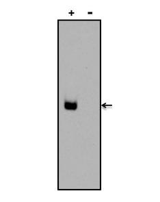 Digoxin Antibody - Chemiluminescent detection of a Digoxin-labeled oligonucleotide was performed by diluting a Digoxin-labeled DNA oligonucleotide (+) or an unlabeled oligonucleotide control (-) in TriTracker Loading Dye, and loading 5pmols onto a 6% DNA Retardation Gel. DNA was transferred to a Biodyne B membrane and blocked for 30 minutes at room temperature. Digoxin was detected using a Digoxin monoclonal antibody at a dilution of 1 µg/mL for 30 minutes at room temperature, followed by a goat anti-mouse IgG-HRP secondary antibody at a dilution of 1:10,000 for at least 30 minutes at room temperature. Detection was performed using the Chemiluminescent Nucleic Acid Detection Module Kit.