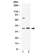 Dihydrodiol Dehydrogenase / AKR1C1 / AKR1C2 Antibody - Western blot testing of 1) rat liver and 2) human HeLa lysate with AKR1C1/2 antibody at 0.5ug/ml. Predicted molecular weight ~37 kDa (AKR1C1) and ~37 kDa (AKR1C2).