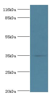 DIMT1L Antibody - Western blot. All lanes: Probable dimethyladenosine transferase antibody at 2 ug/ml+mouse thymus tissue. Secondary antibody: Goat polyclonal to rabbit at 1:10000 dilution. Predicted band size: 35 kDa. Observed band size: 35 kDa.  This image was taken for the unconjugated form of this product. Other forms have not been tested.