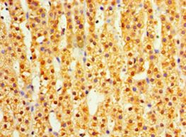 DIMT1L Antibody - Immunohistochemistry of paraffin-embedded human adrenal gland using antibody at 1:100 dilution.  This image was taken for the unconjugated form of this product. Other forms have not been tested.