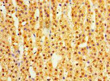 DIMT1L Antibody - Immunohistochemistry of paraffin-embedded human adrenal gland using antibody at 1:100 dilution.  This image was taken for the unconjugated form of this product. Other forms have not been tested.