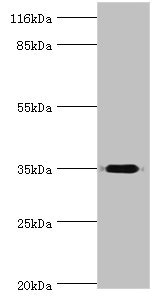 DIMT1L Antibody - Western blot All lanes: Probable dimethyladenosine transferase antibody at 2µg/ml + Mouse thymus tissue Secondary Goat polyclonal to rabbit IgG at 1/10000 dilution Predicted band size: 35 kDa Observed band size: 35 kDa