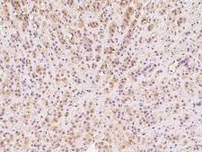 DIMT1L Antibody - Immunochemical staining of human DIMT1 in human adrenal gland with rabbit polyclonal antibody at 1:100 dilution, formalin-fixed paraffin embedded sections.
