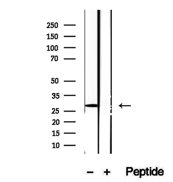 DIO1 / TXDI1 Antibody - Western blot analysis of extracts of mouse lung tissue using DIO1 antibody.