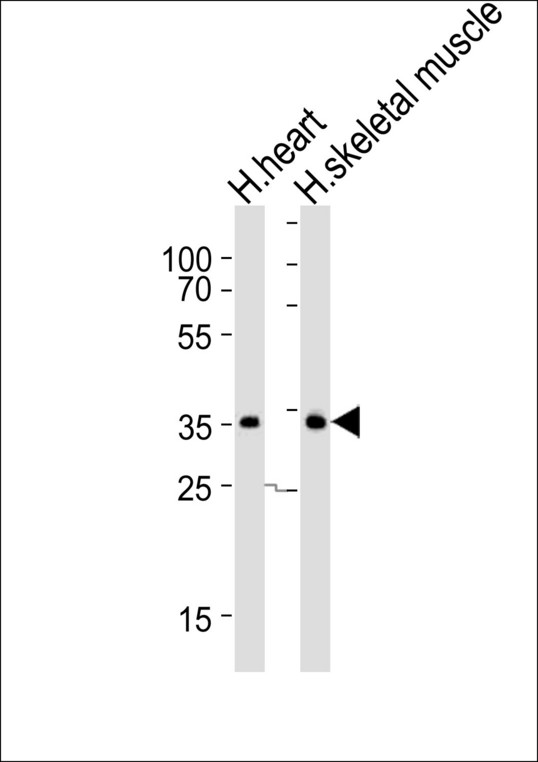 DIO2 Antibody - Western blot of lysates from human heart and human skeletal muscle tissue lysate (from left to right), using DIO2 Antibody. Antibody was diluted at 1:1000 at each lane. A goat anti-rabbit IgG H&L (HRP) at 1:10000 dilution was used as the secondary antibody. Lysates at 35ug per lane.