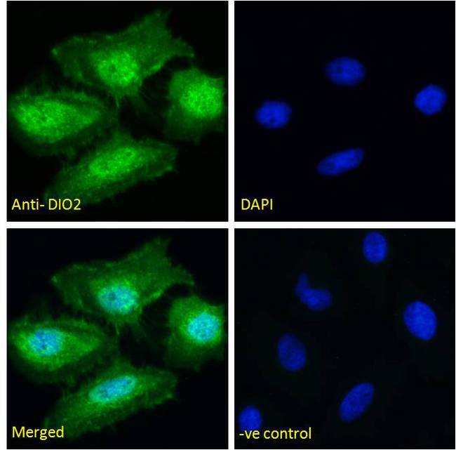 DIO2 Antibody - DIO2 antibody immunofluorescence analysis of paraformaldehyde fixed HeLa cells, permeabilized with 0.15% Triton. Primary incubation 1hr (10ug/ml) followed by Alexa Fluor 488 secondary antibody (2ug/ml), showing nuclear and cytoplasmic staining. The nuclear stain is DAPI (blue). Negative control: Unimmunized goat IgG (10ug/ml) followed by Alexa Fluor 488 secondary antibody (2ug/ml).