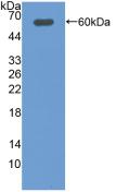 DIO2 Antibody - Western Blot; Sample: Recombinant DIO2, Rat.