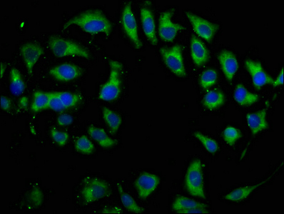 DIO2 Antibody - Immunofluorescence staining of A549 cells at a dilution of 1:133, counter-stained with DAPI. The cells were fixed in 4% formaldehyde, permeabilized using 0.2% Triton X-100 and blocked in 10% normal Goat Serum. The cells were then incubated with the antibody overnight at 4 °C.The secondary antibody was Alexa Fluor 488-congugated AffiniPure Goat Anti-Rabbit IgG (H+L) .