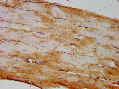 DIO2 Antibody - Immunohistochemistry image at a dilution of 1:400 and staining in paraffin-embedded human skeletal muscle tissue performed on a Leica BondTM system. After dewaxing and hydration, antigen retrieval was mediated by high pressure in a citrate buffer (pH 6.0) . Section was blocked with 10% normal goat serum 30min at RT. Then primary antibody (1% BSA) was incubated at 4 °C overnight. The primary is detected by a biotinylated secondary antibody and visualized using an HRP conjugated SP system.