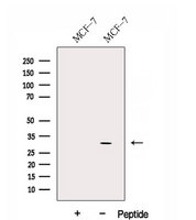 DIO2 Antibody - Western blot analysis of extracts of MCF-7 cells using DIO2 antibody. The lane on the left was treated with blocking peptide.