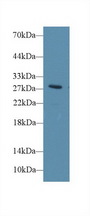 DIO3 Antibody - Western Blot; Sample: Rat Blood Cells lysate; Primary Ab: 1µg/ml Rabbit Anti-Rat DIO3 Antibody Second Ab: 0.2µg/mL HRP-Linked Caprine Anti-Rabbit IgG Polyclonal Antibody