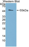 DIO3 Antibody - Western blot of recombinant DIO3.