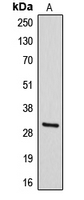 DIO3 Antibody - Western blot analysis of DIO3 expression in HepG2 (A) whole cell lysates.