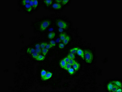 DIO3 Antibody - Immunofluorescent analysis of PC3 cells diluted at 1:100 and Alexa Fluor 488-congugated AffiniPure Goat Anti-Rabbit IgG(H+L)