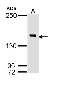 DIP2B Antibody - Sample (30 ug of whole cell lysate). A: Hela. 7.5% SDS PAGE. DIP2B antibody diluted at 1:1000
