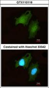 DIP2B Antibody - Immunofluorescence of methanol-fixed HeLa using DIP2B antibody at 1:200 dilution.