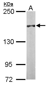 DIP2B Antibody - Sample (50 ug of whole cell lysate). A: Mouse brain. 5% SDS PAGE. DIP2B antibody diluted at 1:1000.