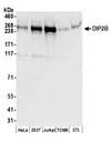 DIP2B Antibody - Detection of human and mouse DIP2B by western blot. Samples: Whole cell lysate (50 µg) from HeLa, HEK293T, Jurkat, mouse TCMK-1, and mouse NIH 3T3 cells prepared using NETN lysis buffer. Antibodies: Affinity purified rabbit anti-DIP2B antibody used for WB at 0.1 µg/ml. Detection: Chemiluminescence with an exposure time of 30 seconds.