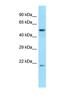 Dipeptidase 2 / DPEP2 Antibody - DPEP2 antibody Western blot of 1 Cell lysate. Antibody concentration 1 ug/ml.  This image was taken for the unconjugated form of this product. Other forms have not been tested.