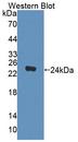 Dipeptidase 2 / DPEP2 Antibody - Western Blot; Sample: Recombinant protein.