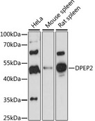 Dipeptidase 2 / DPEP2 Antibody - Western blot analysis of extracts of various cell lines, using DPEP2 antibody at 1:1000 dilution. The secondary antibody used was an HRP Goat Anti-Rabbit IgG (H+L) at 1:10000 dilution. Lysates were loaded 25ug per lane and 3% nonfat dry milk in TBST was used for blocking. An ECL Kit was used for detection and the exposure time was 90s.