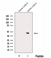 Dipeptidase 2 / DPEP2 Antibody - Western blot analysis of extracts of human kidney tissue using DPEP2 antibody. The lane on the left was treated with blocking peptide.