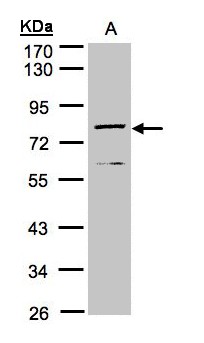 Dipeptidyl Peptidase 3 / DPP3 Antibody - Sample (30 ug of whole cell lysate). A: MOLT4. 10% SDS PAGE. Dipeptidyl Peptidase 3 / DPP3 antibody diluted at 1:1000