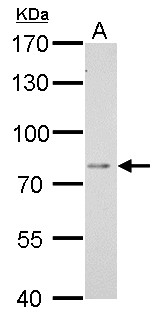 Dipeptidyl Peptidase 3 / DPP3 Antibody - DPP3 antibody [N2C1], Internal detects DPP3 protein by Western blot analysis. A. 30 ug BCL-1 whole cell lysate/extract. 7.5 % SDS-PAGE. DPP3 antibody [N2C1], Internal dilution:1:1000