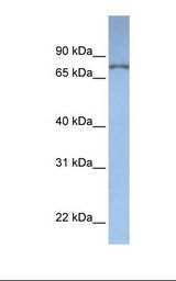 Dipeptidyl Peptidase 3 / DPP3 Antibody - Jurkat cell lysate. Antibody concentration: 1.0 ug/ml. Gel concentration: 12%.  This image was taken for the unconjugated form of this product. Other forms have not been tested.